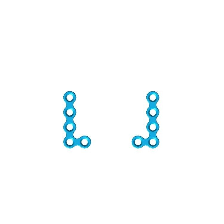 스트레이트 타입 악안면외상 뼈 플레이트와 나사